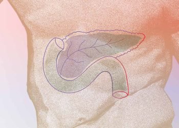 Nye tal: Flere overlever bugspytkirtelkræft (pancreascancer)